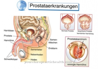 erekcijos poveikis prostatos vyrai padidino varpa