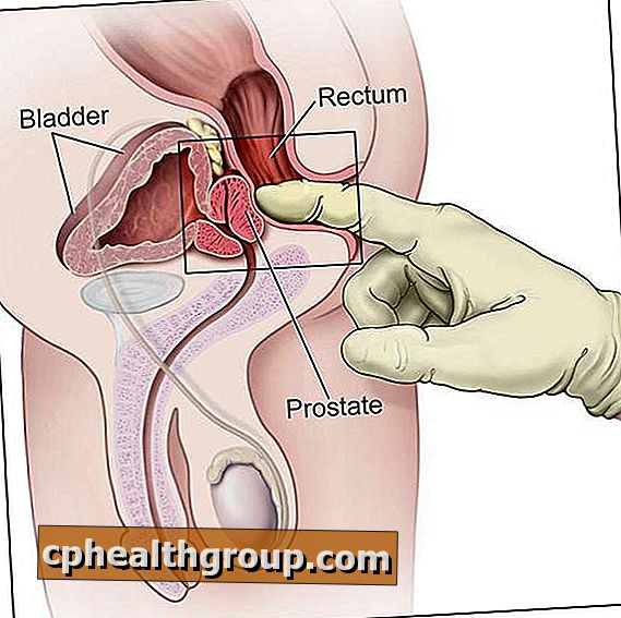kaip prostatito gydymas veikia erekciją?